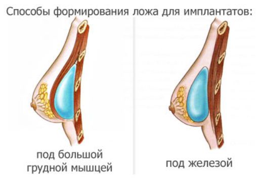 Как увеличит грудные железы в домашних условиях отзывы - Vendservice.ru