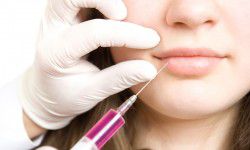 Контурная пластика губ