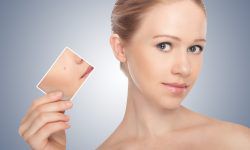 Удаление новообразований кожи фотографии до и после